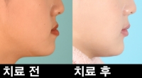 블로그 포스트01